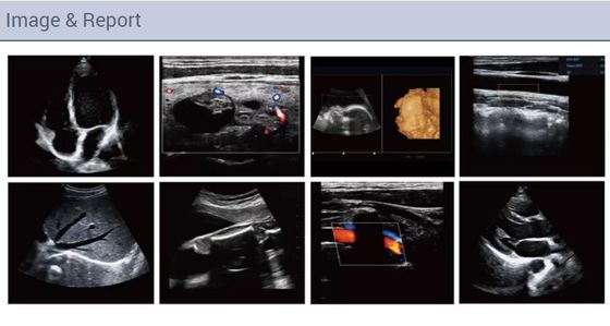 Máquina llena portátil del escáner del ultrasonido de Doppler del color de Figital de la cardiología cardiovascular