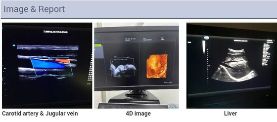 carretilla cardiaca Echo Color Doppler Ultrasound Machine de la 2.a ecocardiografía de 3D 4D