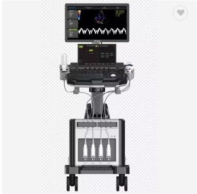 carretilla cardiaca Echo Color Doppler Ultrasound Machine de la 2.a ecocardiografía de 3D 4D