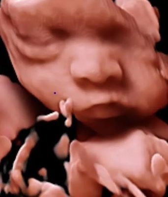 escáner del ultrasonido de la carretilla del ultrasonido de Doppler del color de 3D 4D 5D para OB GYN