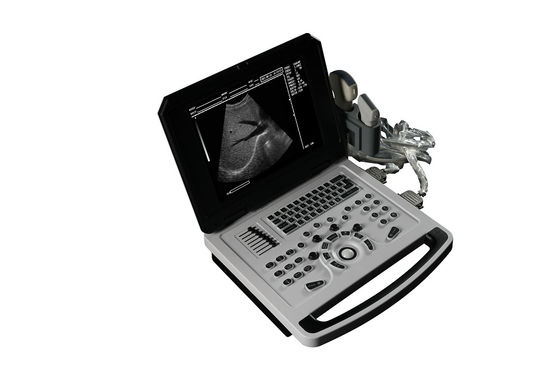 Cuaderno de notas Escáner de ultrasonido en blanco y negro para cardiología