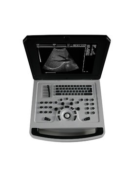 Cuaderno de notas Escáner de ultrasonido en blanco y negro para cardiología