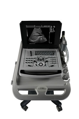 Cuaderno de notas Escáner de ultrasonido en blanco y negro para cardiología