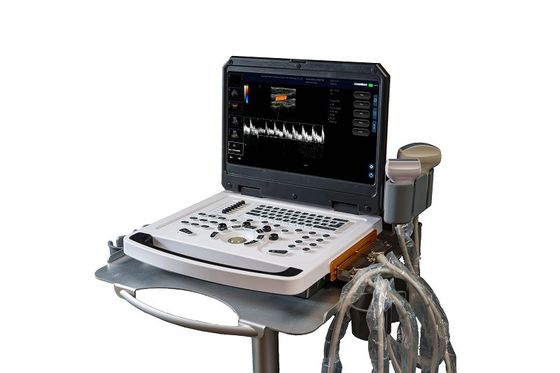 CE Escaner de máquina de ultrasonido Doppler a color portátil OEM