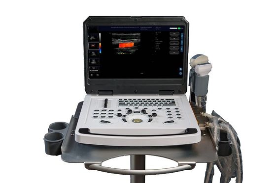 CE Escaner de máquina de ultrasonido Doppler a color portátil OEM